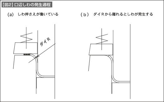 【図2】口辺しわの発生過程